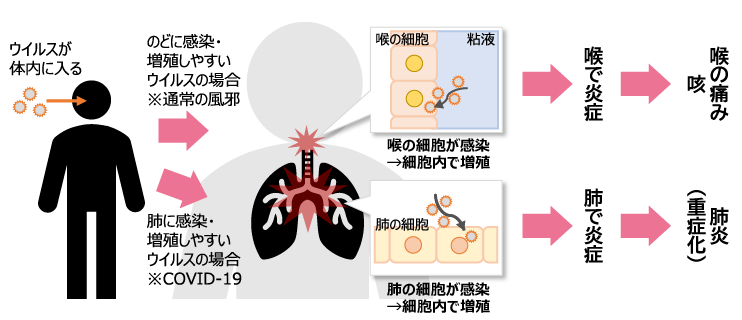 図1　ウイルスの感染部位と症状